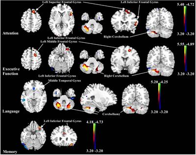 The Frontal and Cerebellar Metabolism Related to Cognitive Dysfunction in Multiple System Atrophy